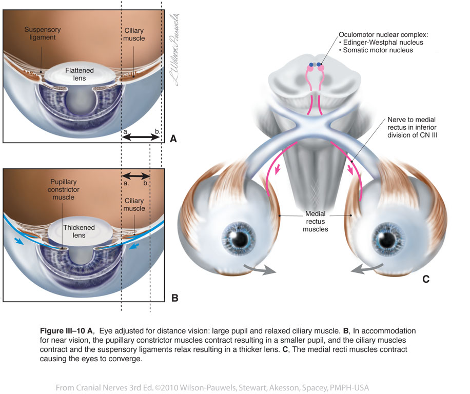 constriction of pupil cranial nerve