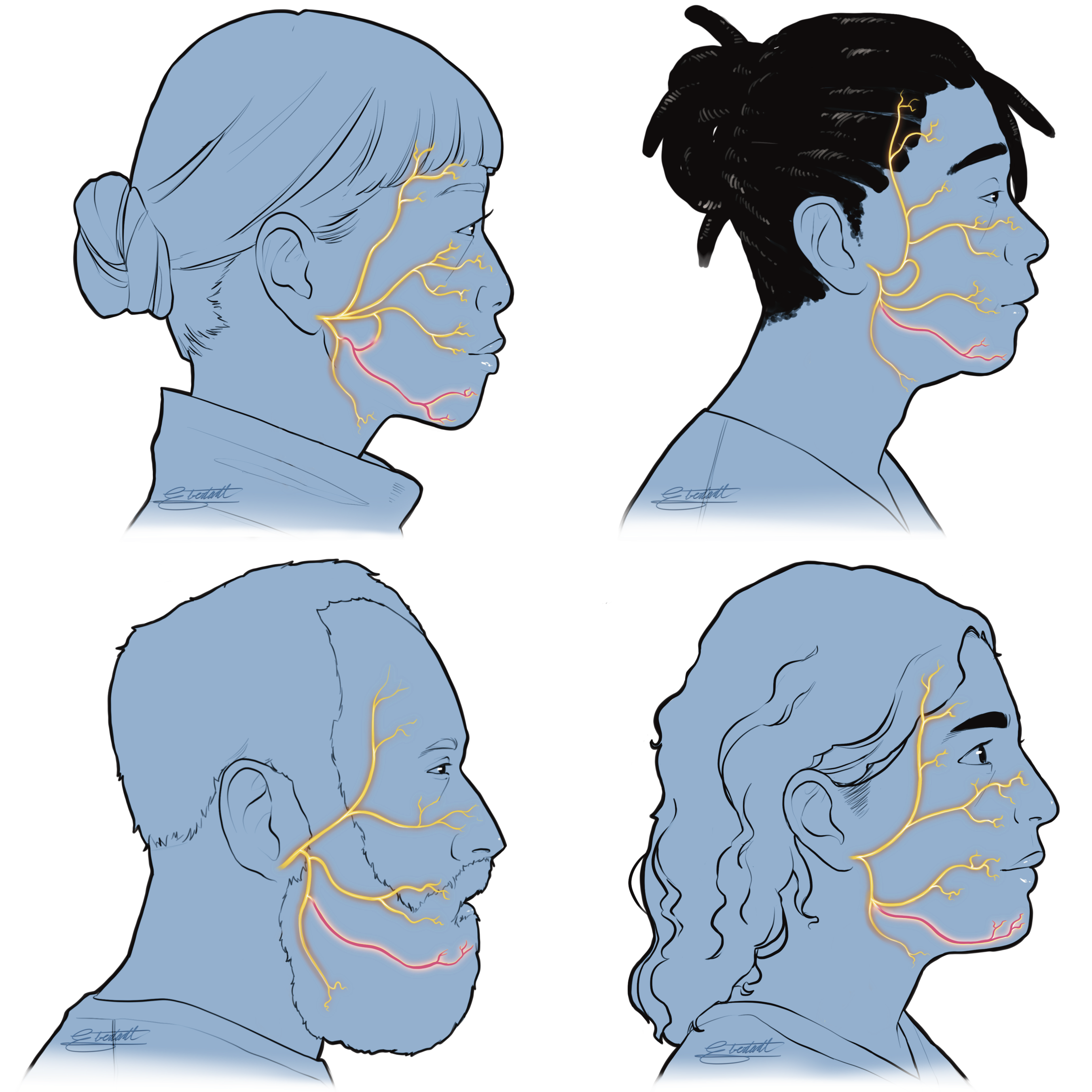Image of four people with the marginal mandibular branch of the facial nerve highlighted.