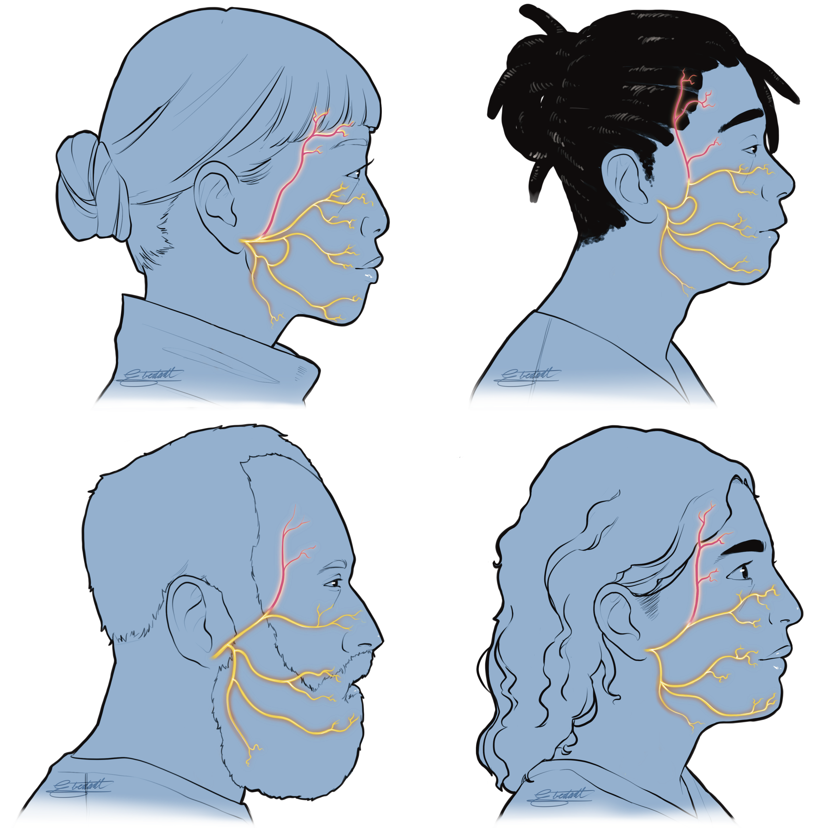 Image of four people with the temporal branch of the facial nerve highlighted.