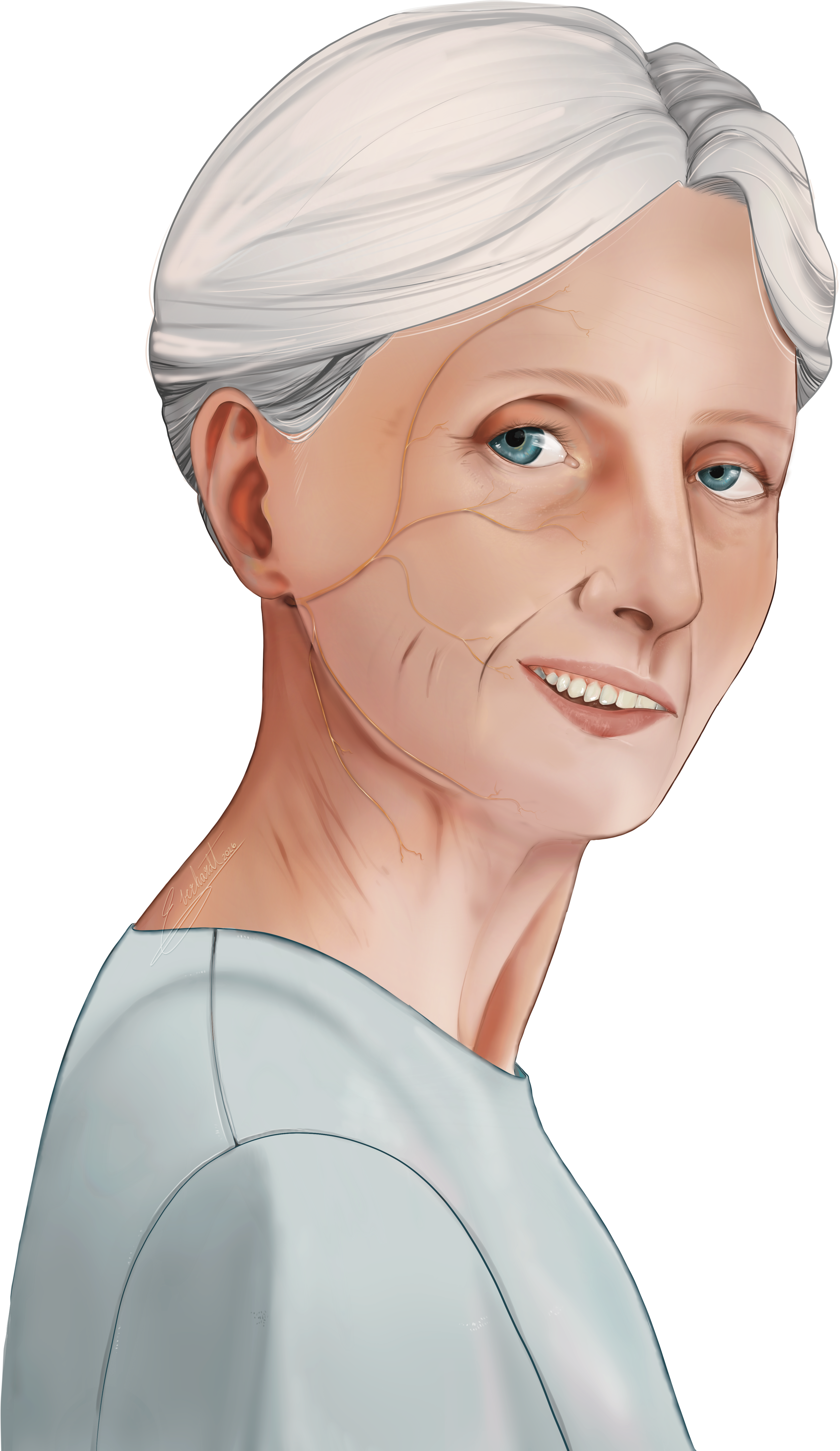 Image of older white woman with a gentle smile with facial paralysis