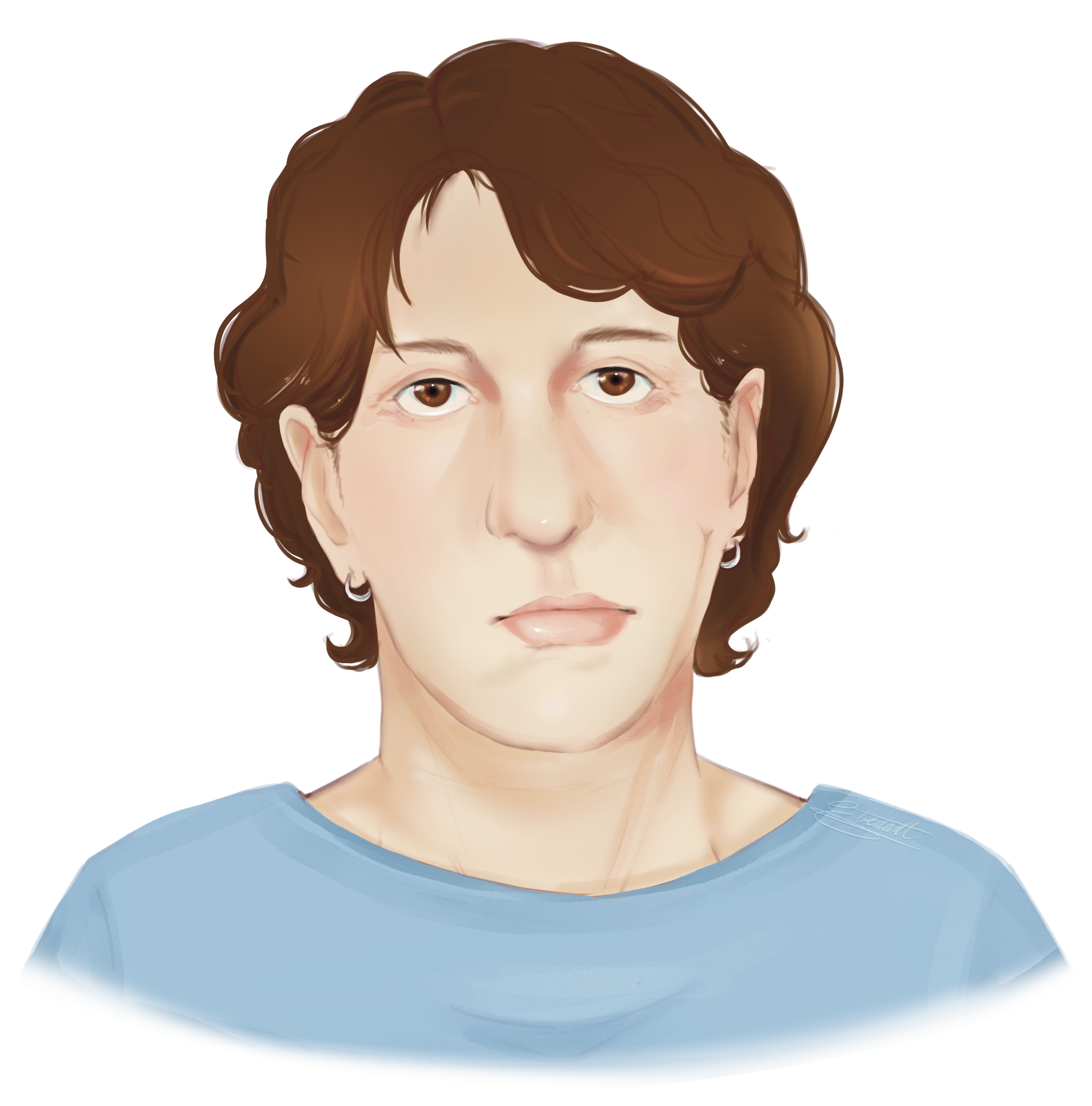 Image of a middle aged white woman with right-sided facial paralysis with her face in a resting state.