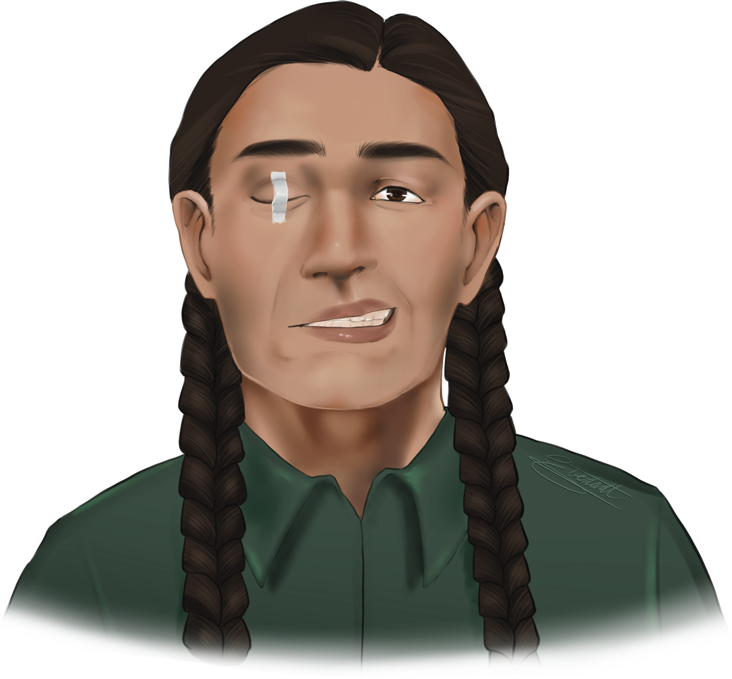 An image of a middle aged indigenous man with right-sided facial paralysis taping his right eye shut for protection.
