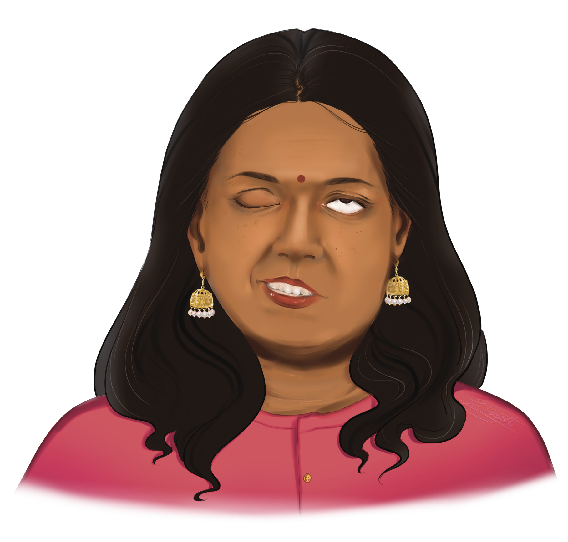 Image of a middle aged Indian woman with left sided facial paralysis trying to close her eye. The paralyzed eye rolls back and does not close, also known as Bell's reflex.